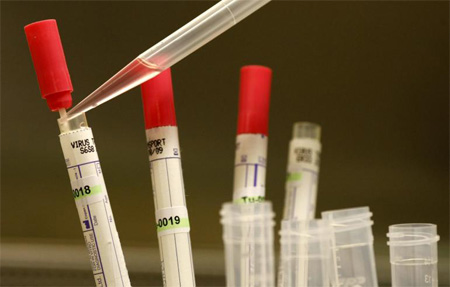 OMS: 2 enfermos de ébola en Liberia tratados con ZMapp muestran una clara mejoría